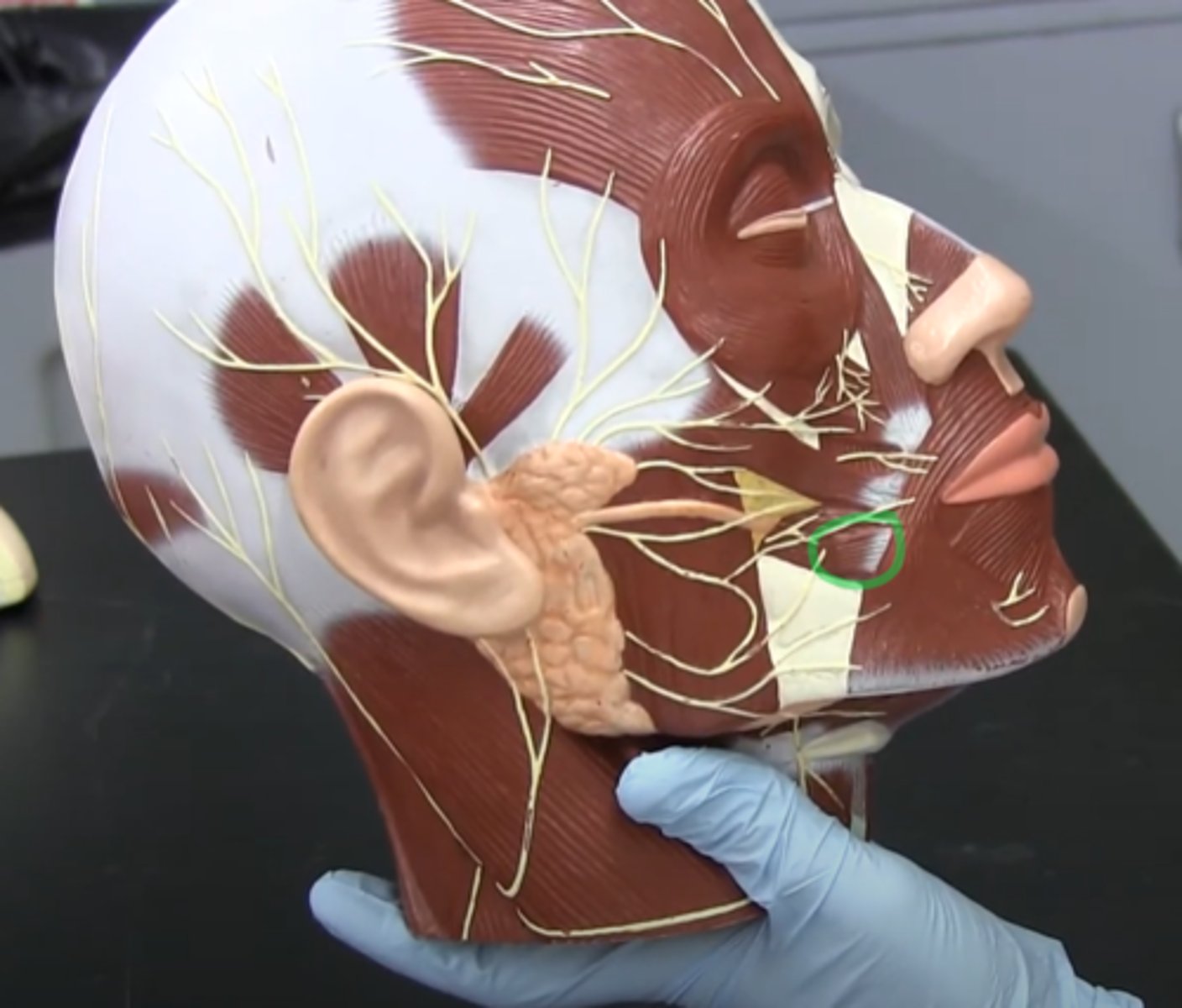 <p>(Bottom) a slender band of muscle on each side of the face that arises from the zygomatic bone, inserts into the orbicularis oris and skin at the corner of the mouth, and acts to pull the corner of the mouth upward and backward when smiling or laughing.</p><p>*The structure is clipped on this model so you can only see s small piece of it*</p>