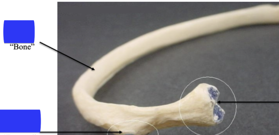 <p>Identify this bone</p>