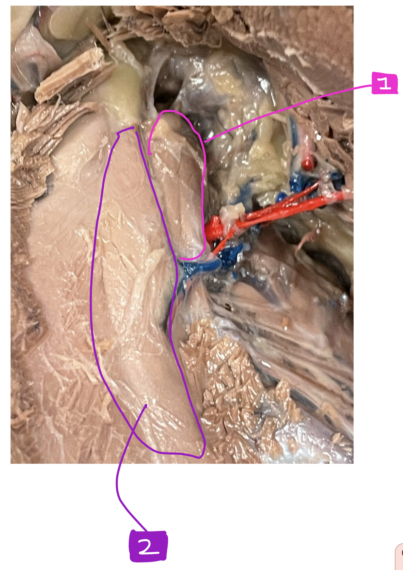 What muscle in the bird is #1?