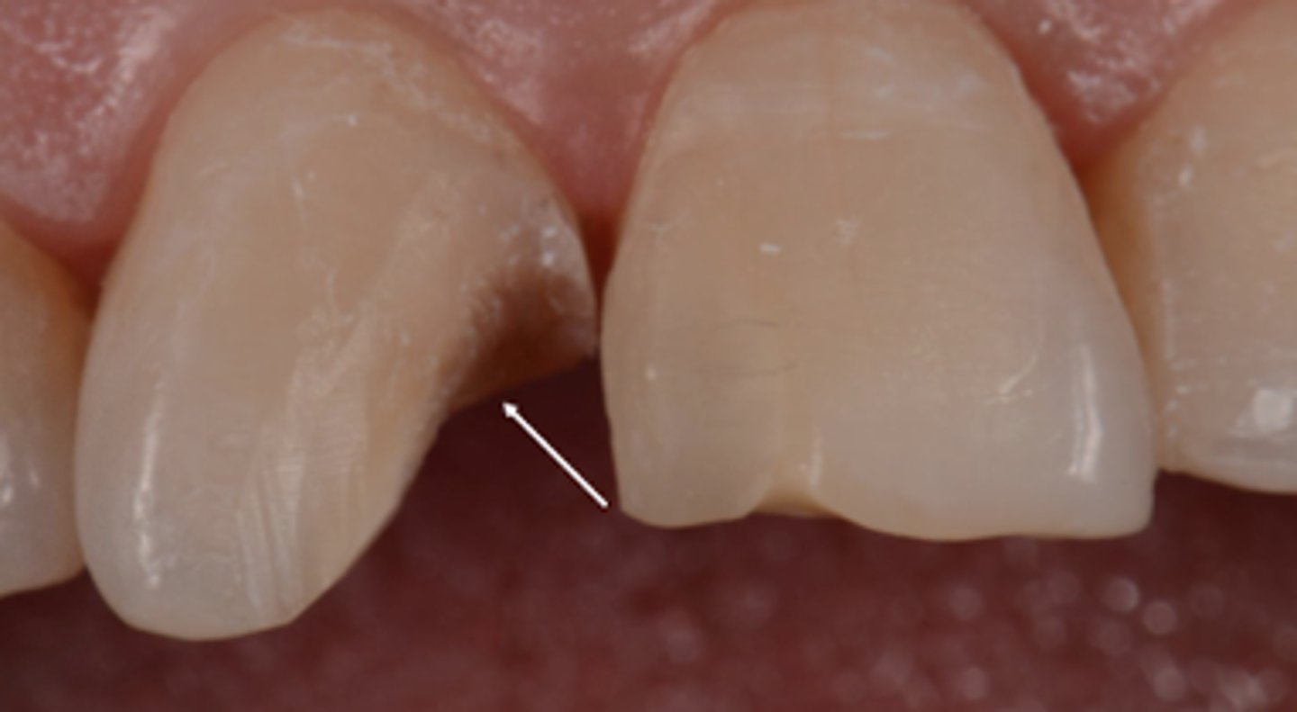 <p>This is most likely what?</p>