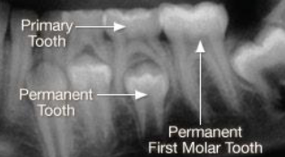 <p><span><strong>How to use the differences in identifying the dentition in </strong></span><strong>radiographs: start with the roots&nbsp;</strong></p>