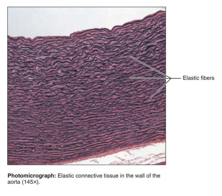 <p>Function: allows recoil of tissue following stretching; maintains pulsatile flow of blood through arteries; aids passive recoil of lungs following inspiration</p><p></p><p>Location: walls of large arteries; within certain ligaments associated with vertebral column, within the walls of the bronchial tubes</p>