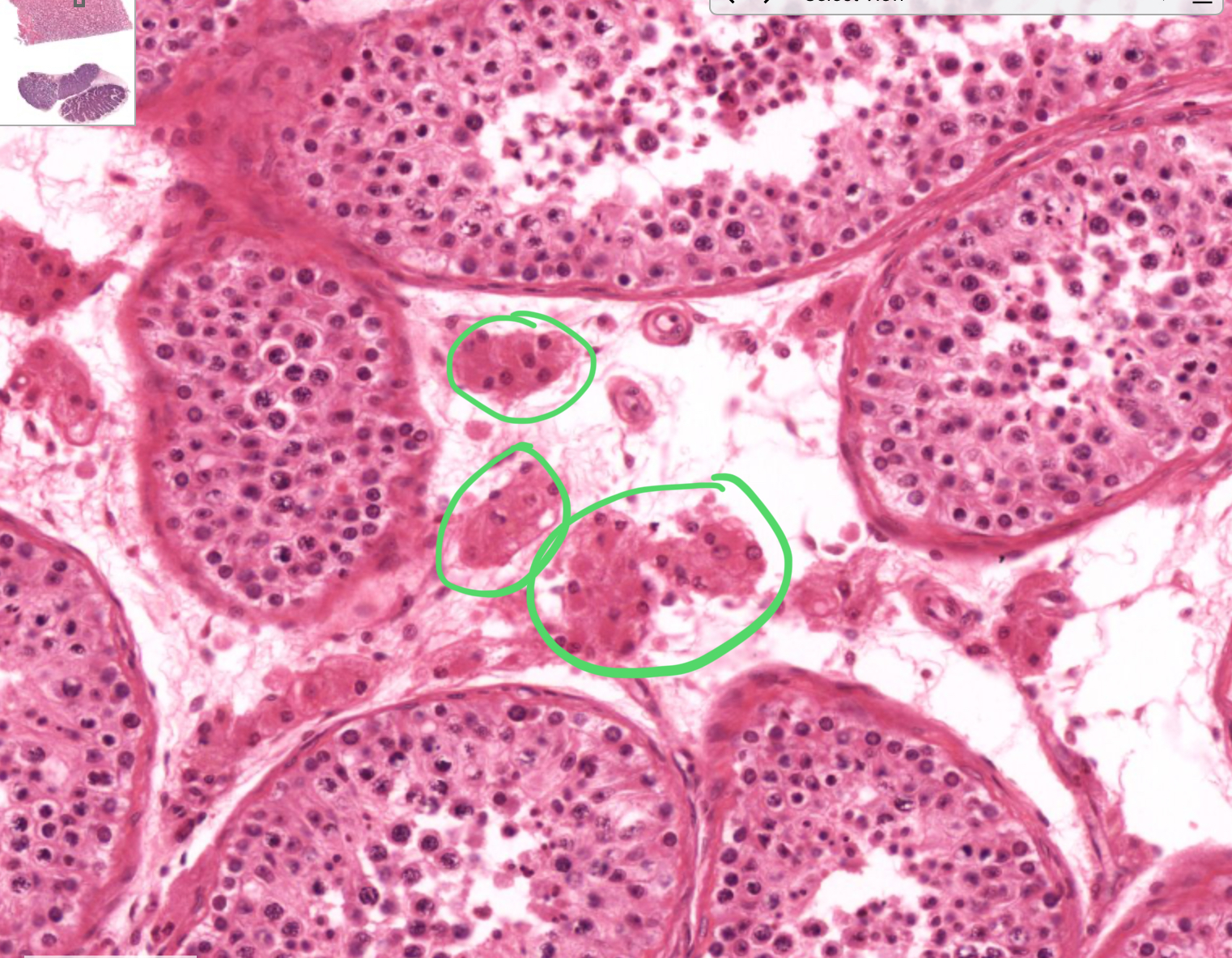 <p>histo; “clumps” between circles </p>