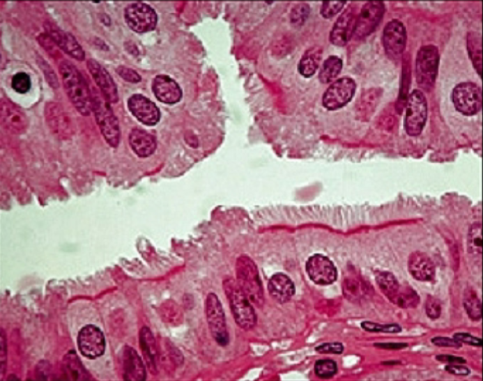 <p>What is the function of the ciliated simple columnar epithelium?</p>