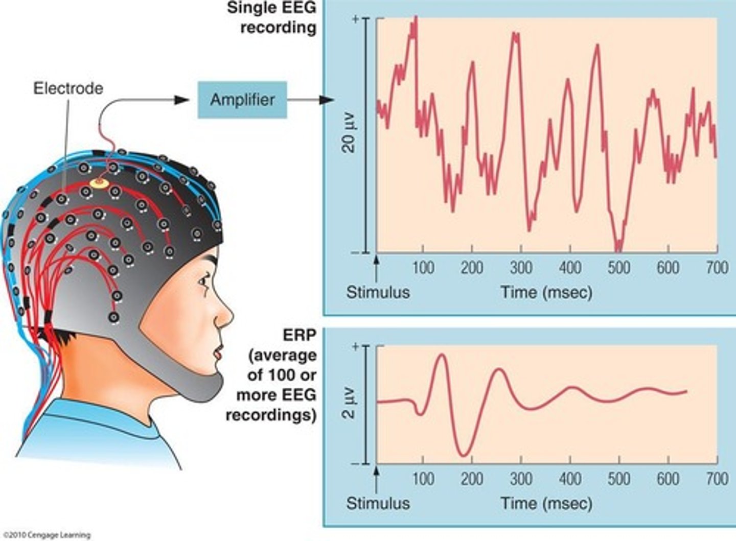 <p>Electroencephalogram.</p>