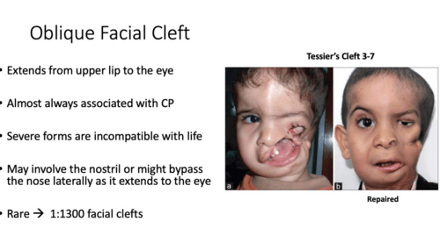 <p>What is the oblique facial cleft (rare) extend from? what is it almost always associated with? </p>