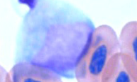 <p>What WBC is this?</p>