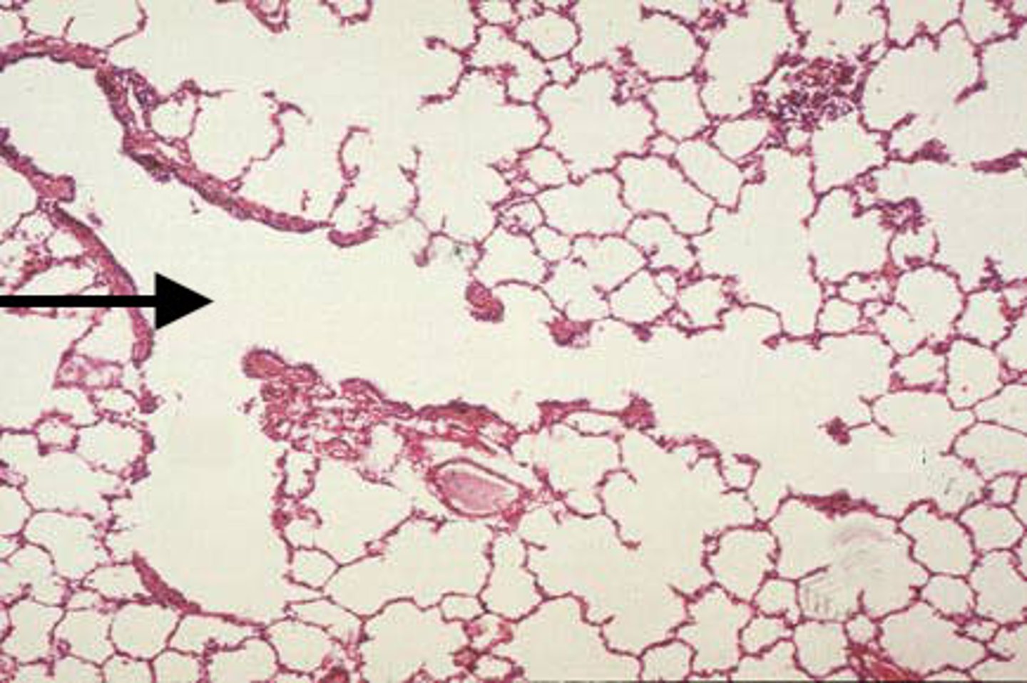 <p>Identify the organ indicated by the arrow.</p>