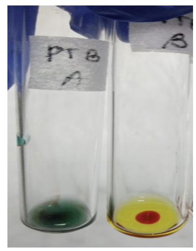 <p>Identify the:</p><ul><li><p>Blood Group</p></li><li><p>Antibody/Antibodies Present</p></li><li><p>Antigen(s) Present</p></li></ul><p></p><p>Grade the Reaction</p><ul><li><p>Anti-A Sera:</p></li><li><p>Anti-B Sera:</p></li></ul><p></p>