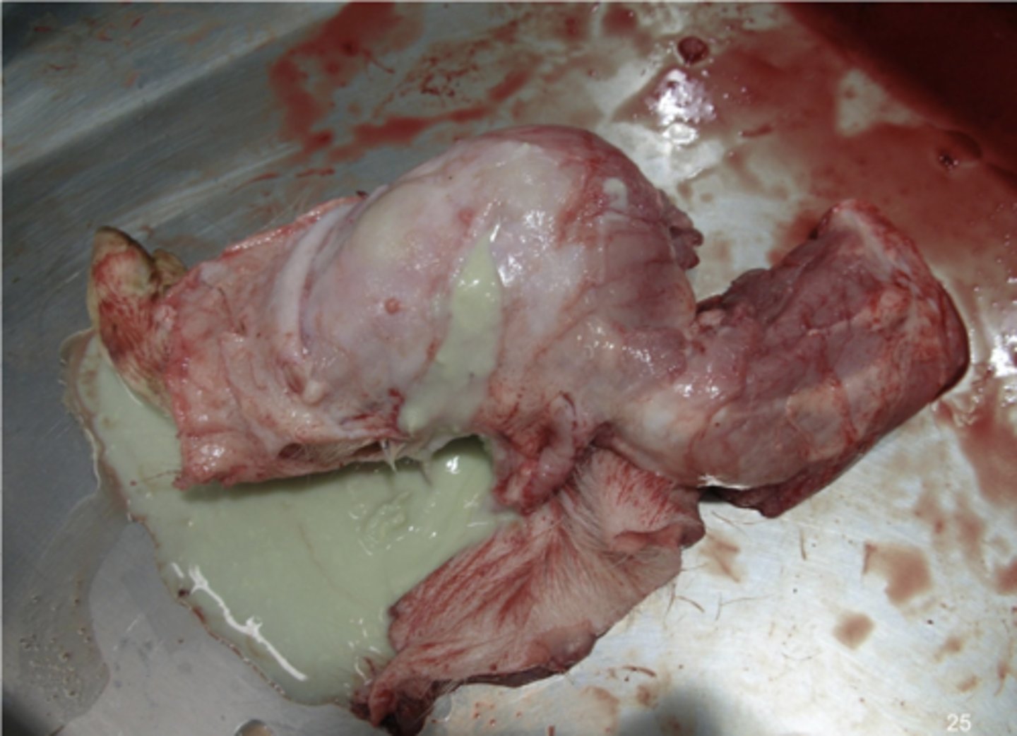 <p>pyogenic bacteria infection</p><p>OR if it is in the brain, hypoxia</p>