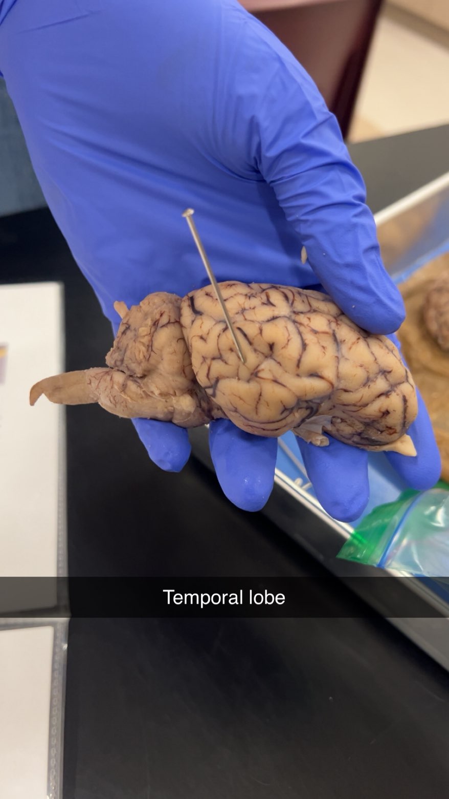 <p>auditory lobe associated with processing sound and integrating sensory information. </p>
