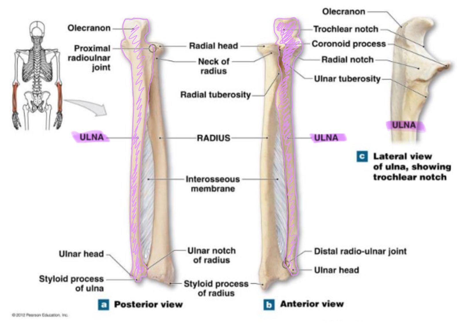 <p>main bone of the forearm that forms the elbow joint w/ the humerus; allows pronation and supination; identified by large hook at the top of bone</p>