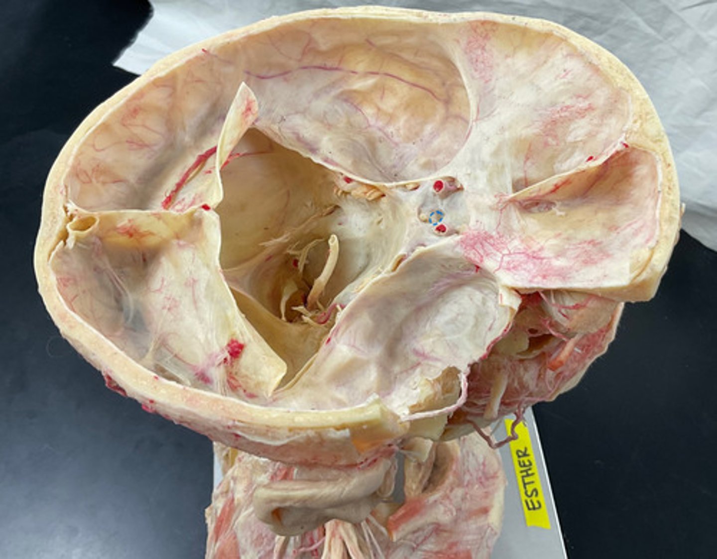 knowt flashcard image