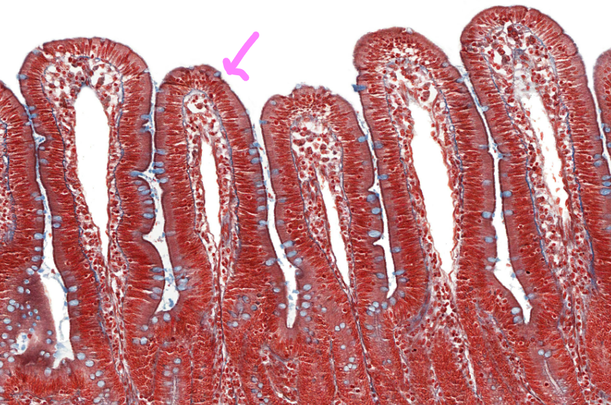 small intestine