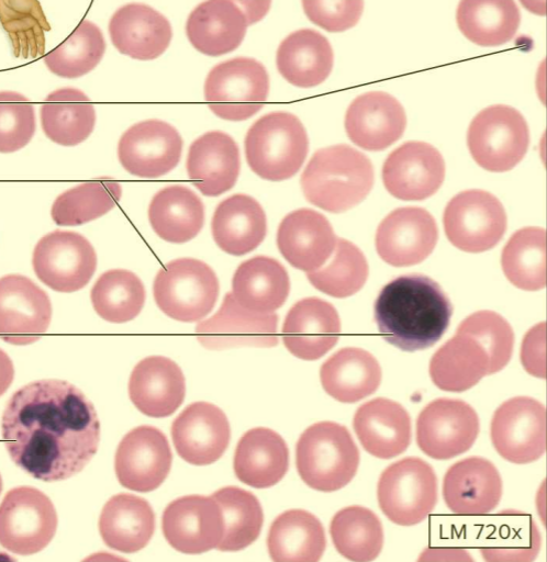 <p>What type of tissue?</p>