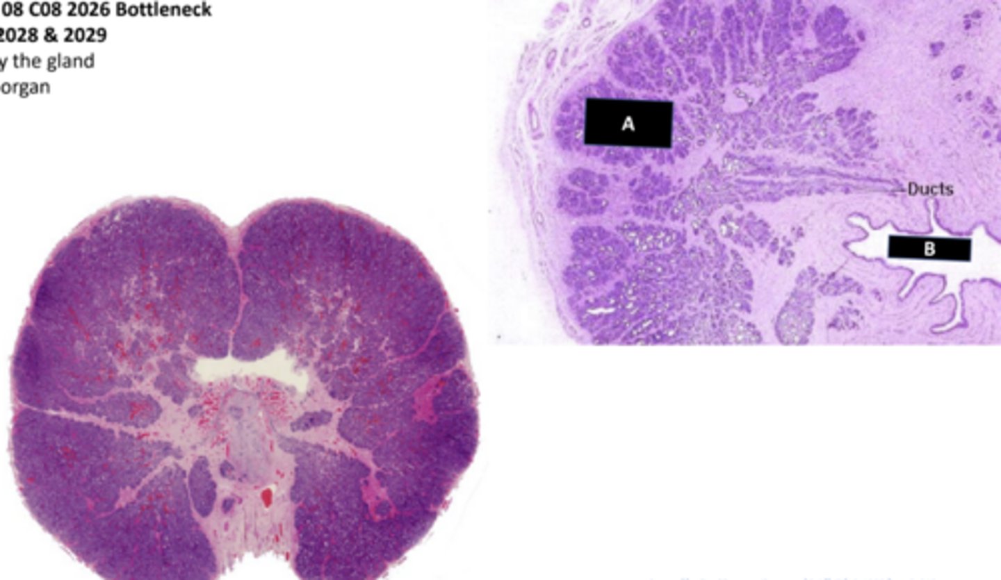 <p>organ</p>