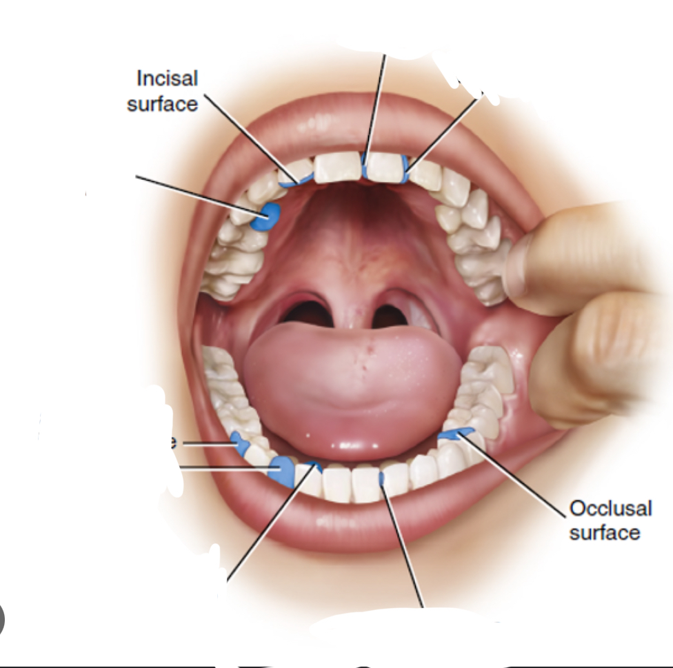 <ul><li><p>Incisal (anterior)</p></li><li><p>Occlusal (posterior)</p></li></ul><p></p>