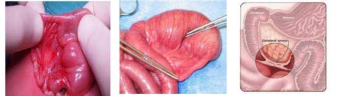 <p>identify then define</p>