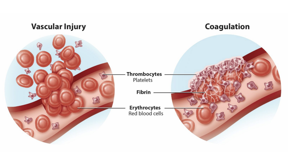 <p><strong>platelets (thrombocytes)</strong></p><ul><li><p>coagulation</p><ul><li><p>______</p></li><li><p>soluble (in presence of vascular injury) → insoluble (mesh-like network)</p></li></ul></li><li><p>platelet activation</p><ul><li><p>contact with ______ and von Willebrand</p></li><li><p>fibrin</p></li></ul></li><li><p>immune responses</p><ul><li><p>inflammation </p><ul><li><p>secrete cytokines</p></li></ul></li><li><p>_______</p></li></ul></li></ul><p></p>
