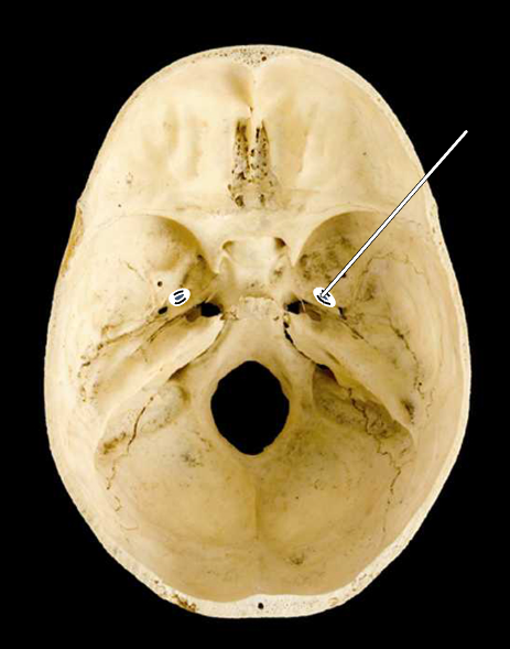 <p>Name the highlighted portion.</p><p>(Skull, superior view of cranial cavity holes).</p>