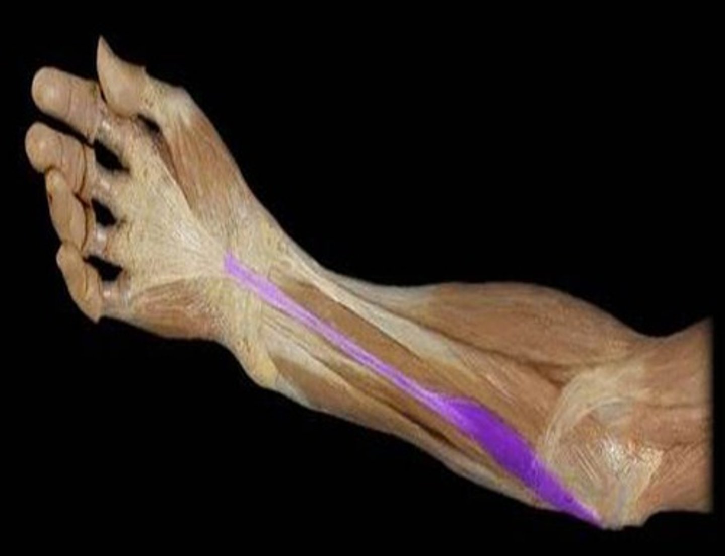 <p>What is the name of this muscle, highlighted in purple?</p>