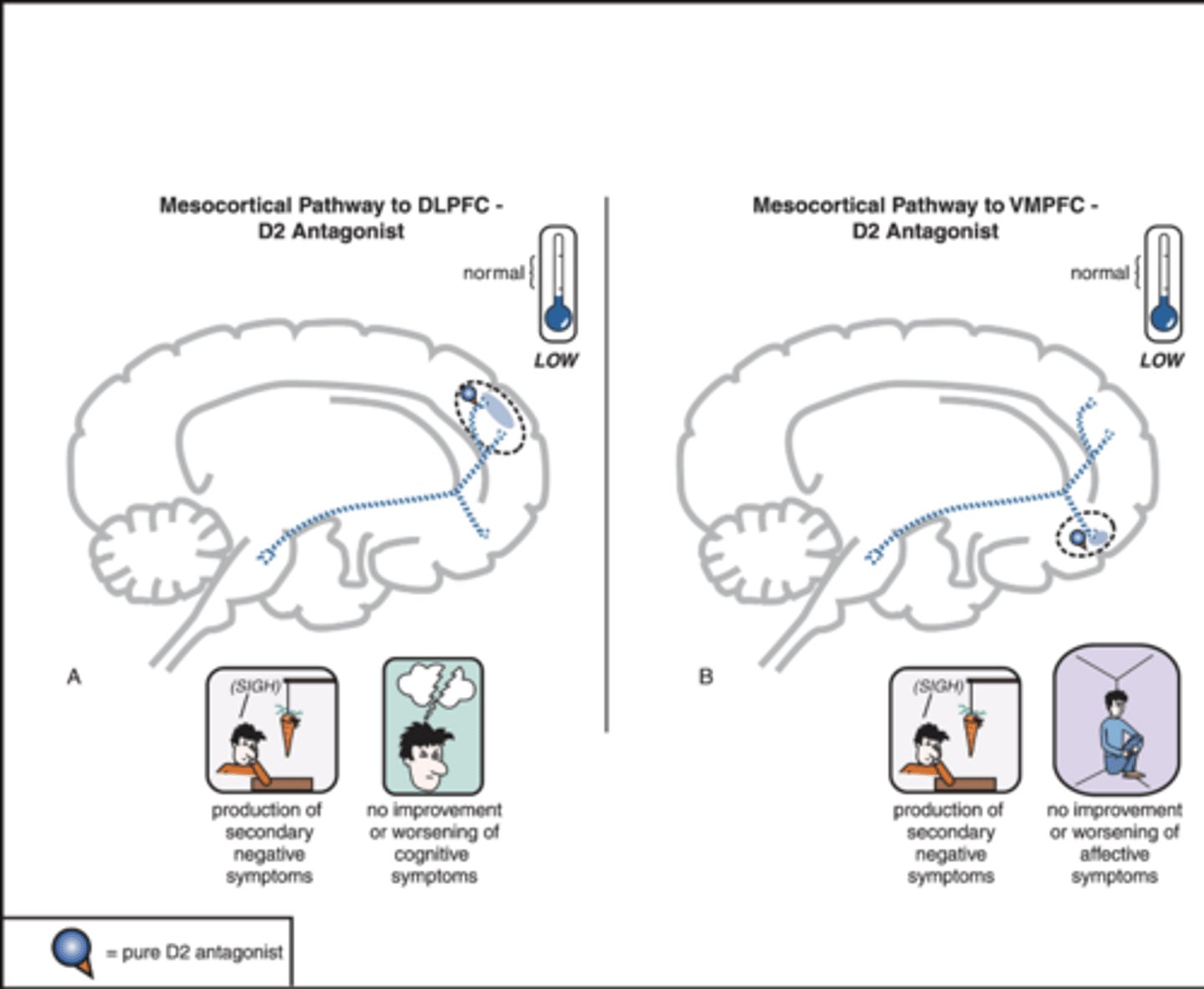 <p>-Left: DLPFC (worsens motivation and cognitive function)</p><p>-Right: VMPFC (worsens motivation and increases social withdrawal)</p><p>-Worsens negative symptoms (bad)</p>