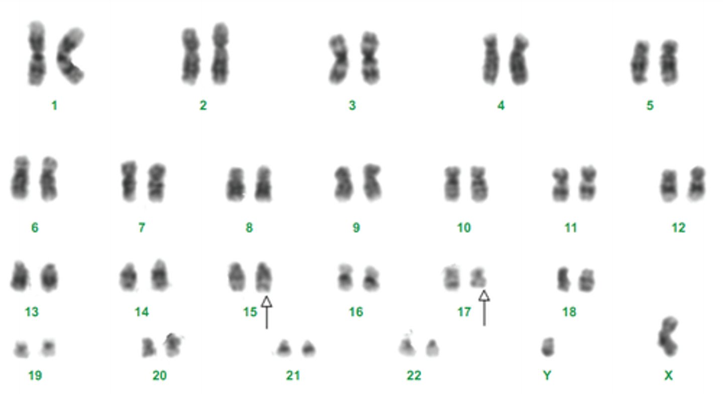 <p>when non homologous chromosomes exchange parts.</p>