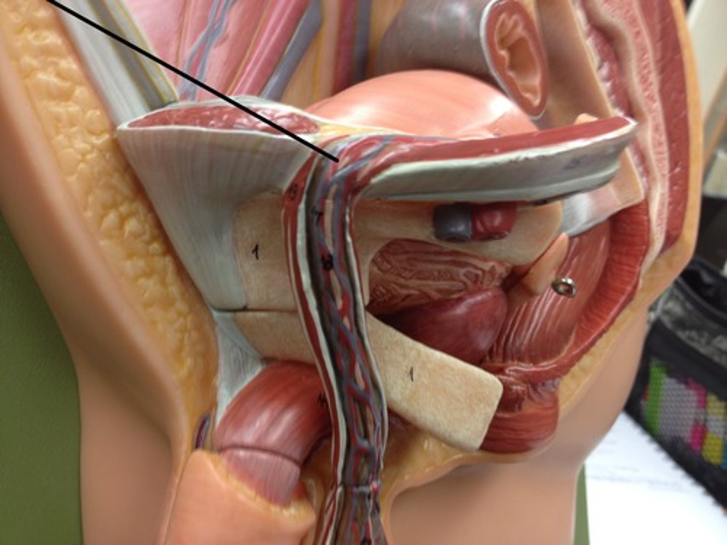 <p>the channel in the abs which the spermatic cord travels through (males) or round ligament of uterus (female)</p>