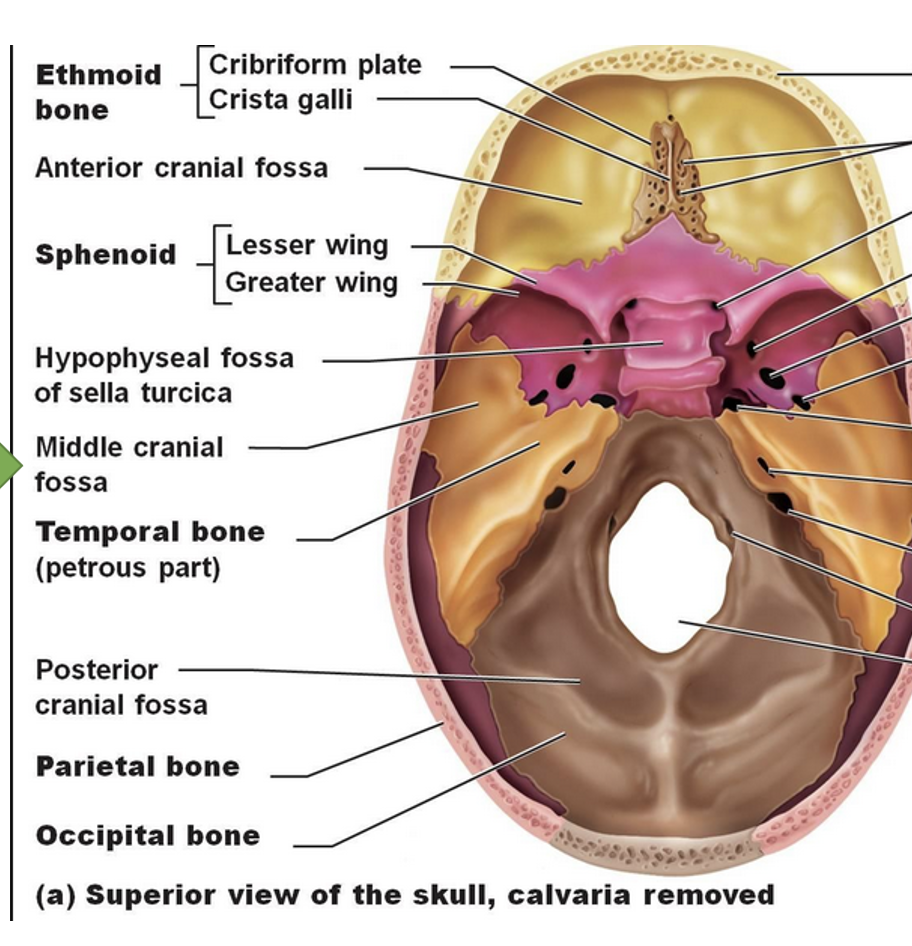 <p>Lesser wing of sphenoid bone</p>
