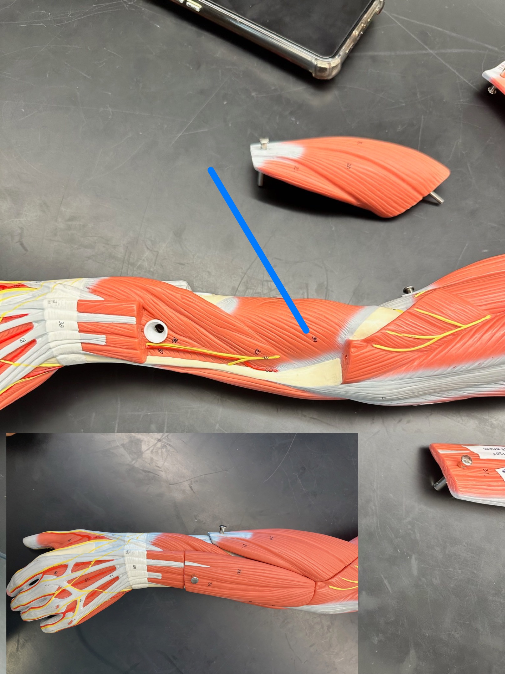 <p>ID muscle</p>
