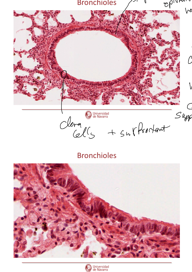 <p>Top circle: simple ciliated epithelium, no goblet cells, smooth muscle layer, and since no cartilage it can have clara cells.</p><p>Botoom circle: Clara cells with surfactant. </p>