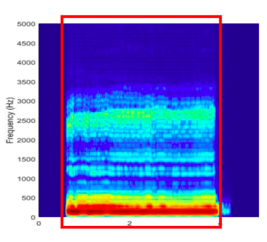 <p>Which type of consonant is shown in the spectrogram?</p><p>-nasal</p><p>-fricative</p><p>-stop</p><p>-glide</p>