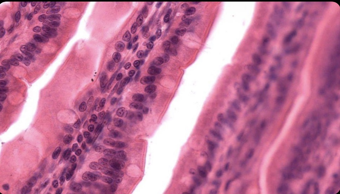 <p>Células epiteliales glandulares caliciformes asociadas al epitelio </p>