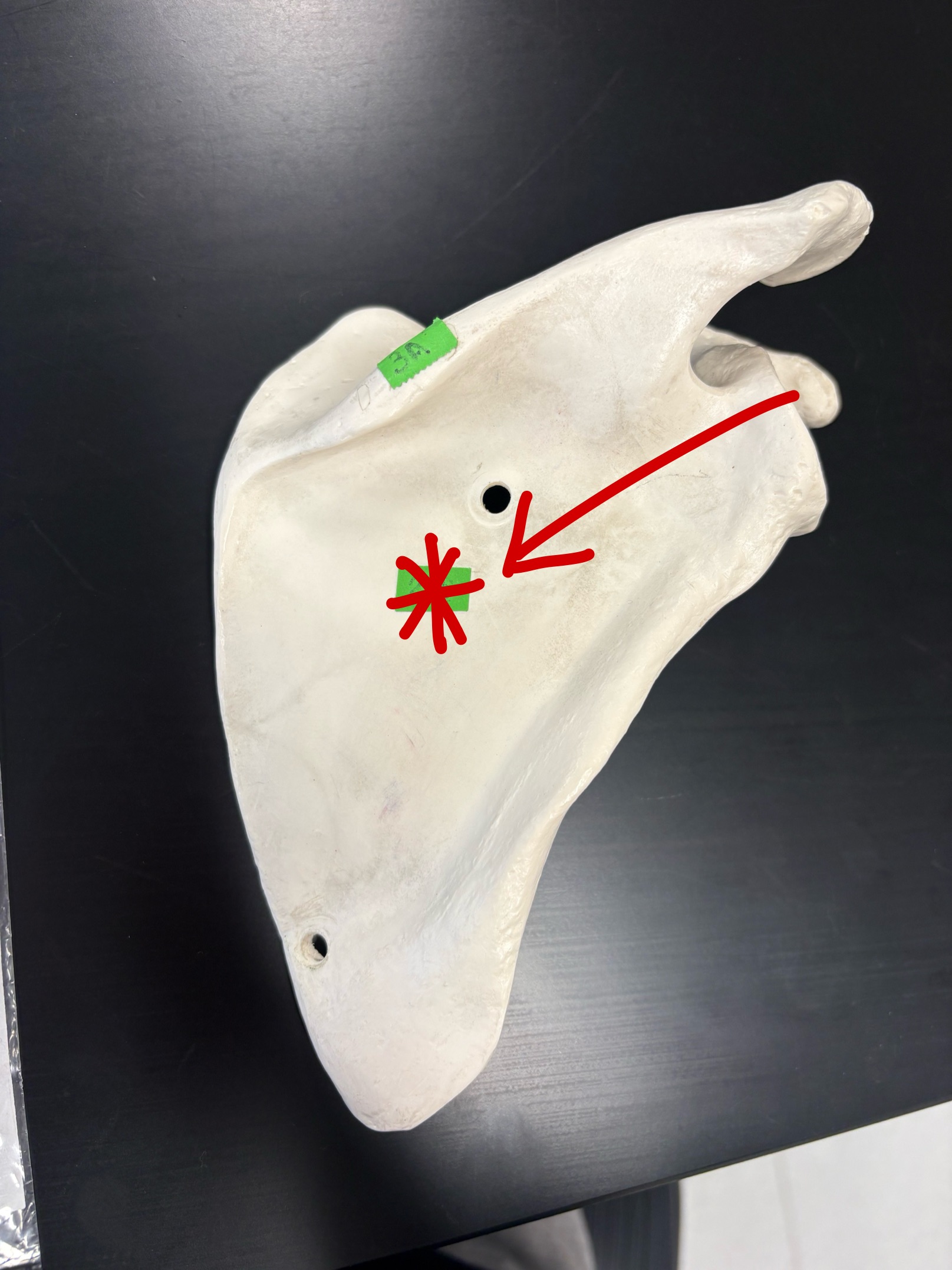 <p>Name this structure</p>