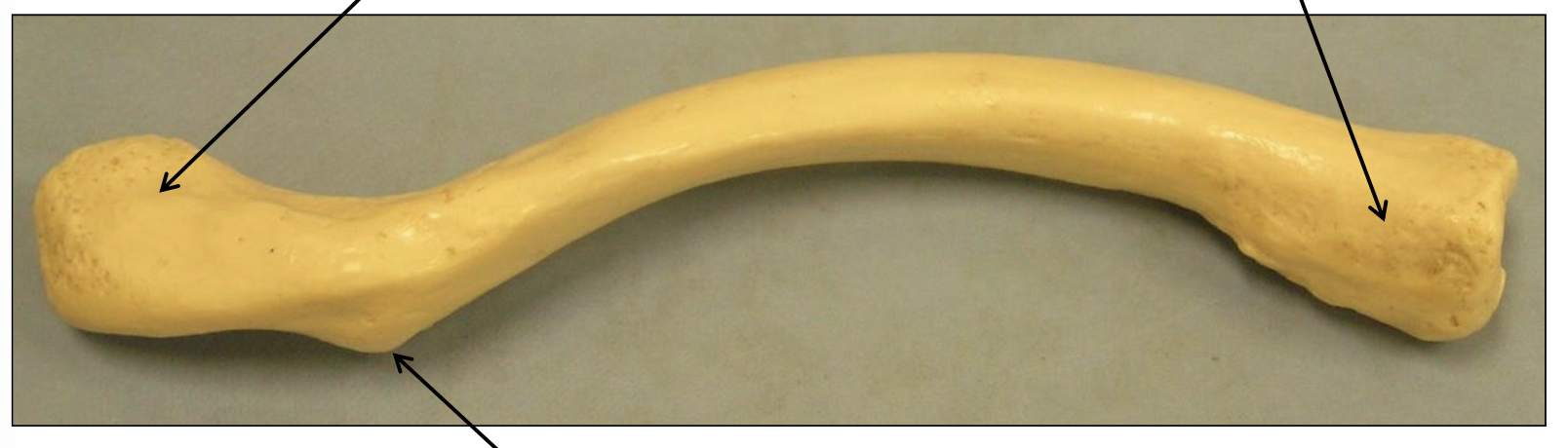 <p>Name the bone.</p>