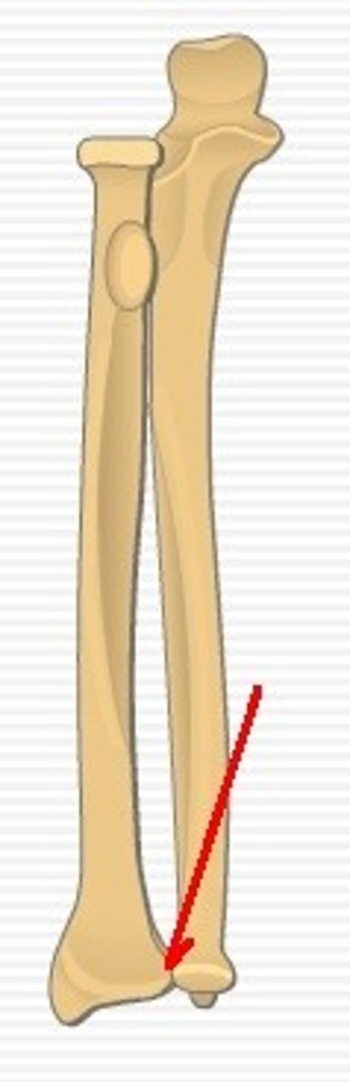 <p>articulates with the head of the ulna</p>
