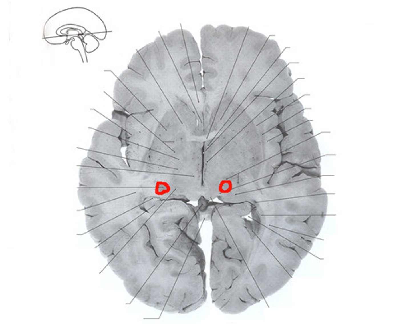 <p>Thalamic nucleus relaying visual information</p>