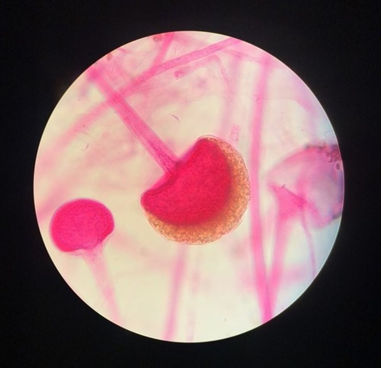 <p>Kulmögel, (zygomyceter)</p>