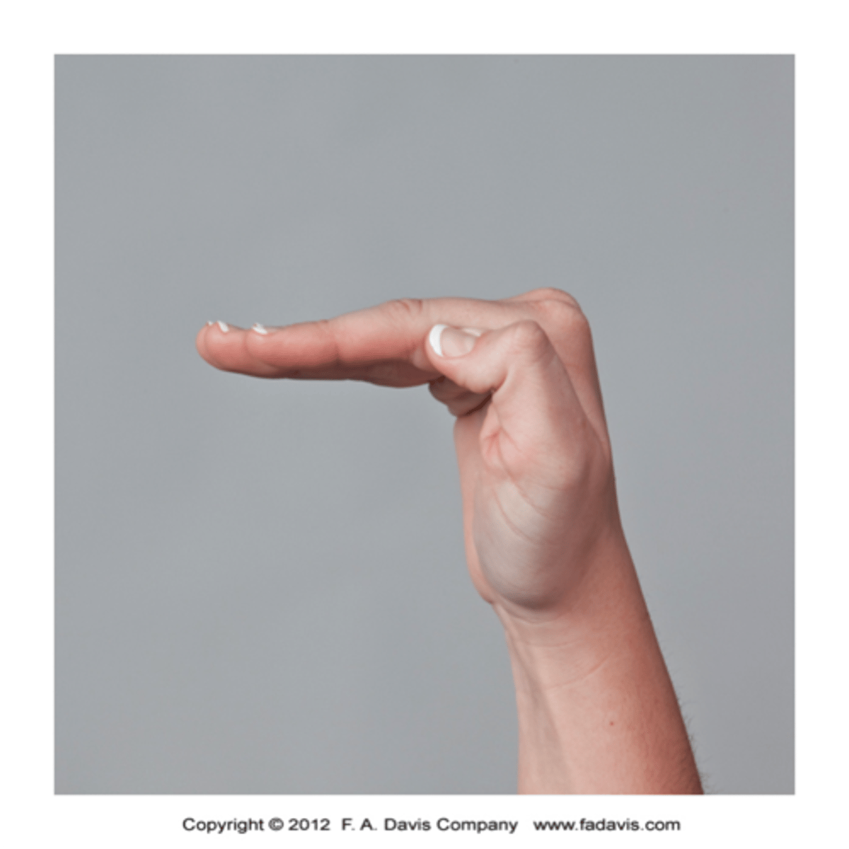 <p>MCP flexion, PIP and DIP extension</p>