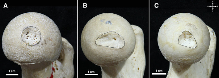 <p>What bone structure is this?</p>