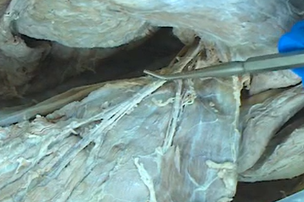 <p>The nerve that innervates the latissimus dorsi muscle.</p>