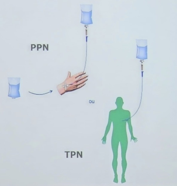 <ul><li><p>NP centrale (TPN) → administré par une voie de grande taille </p></li><li><p>NP périphérique (PPN) → administré par une voie de petite taille </p></li></ul><p></p>