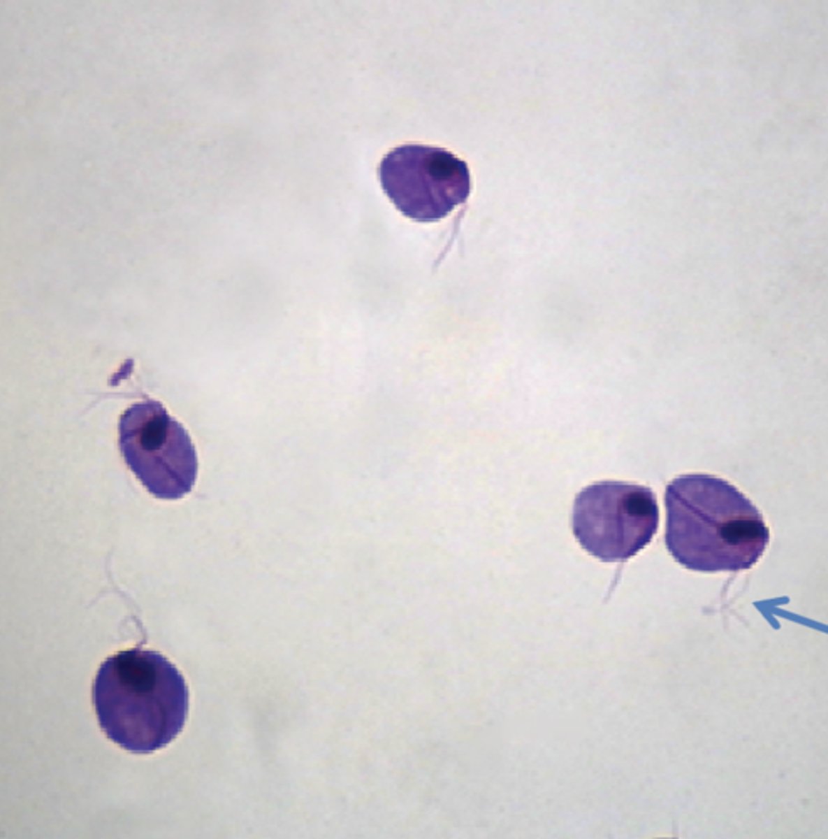 <p>protozoan parasite</p><p>flagella</p>