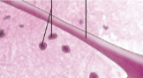 <p>Axon (nerve fibers)</p>