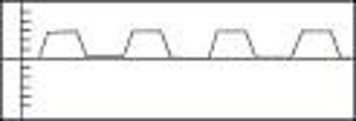 <p>a distinct pattern of breathing characterized by prolonged pauses occurring following inspiration</p>
