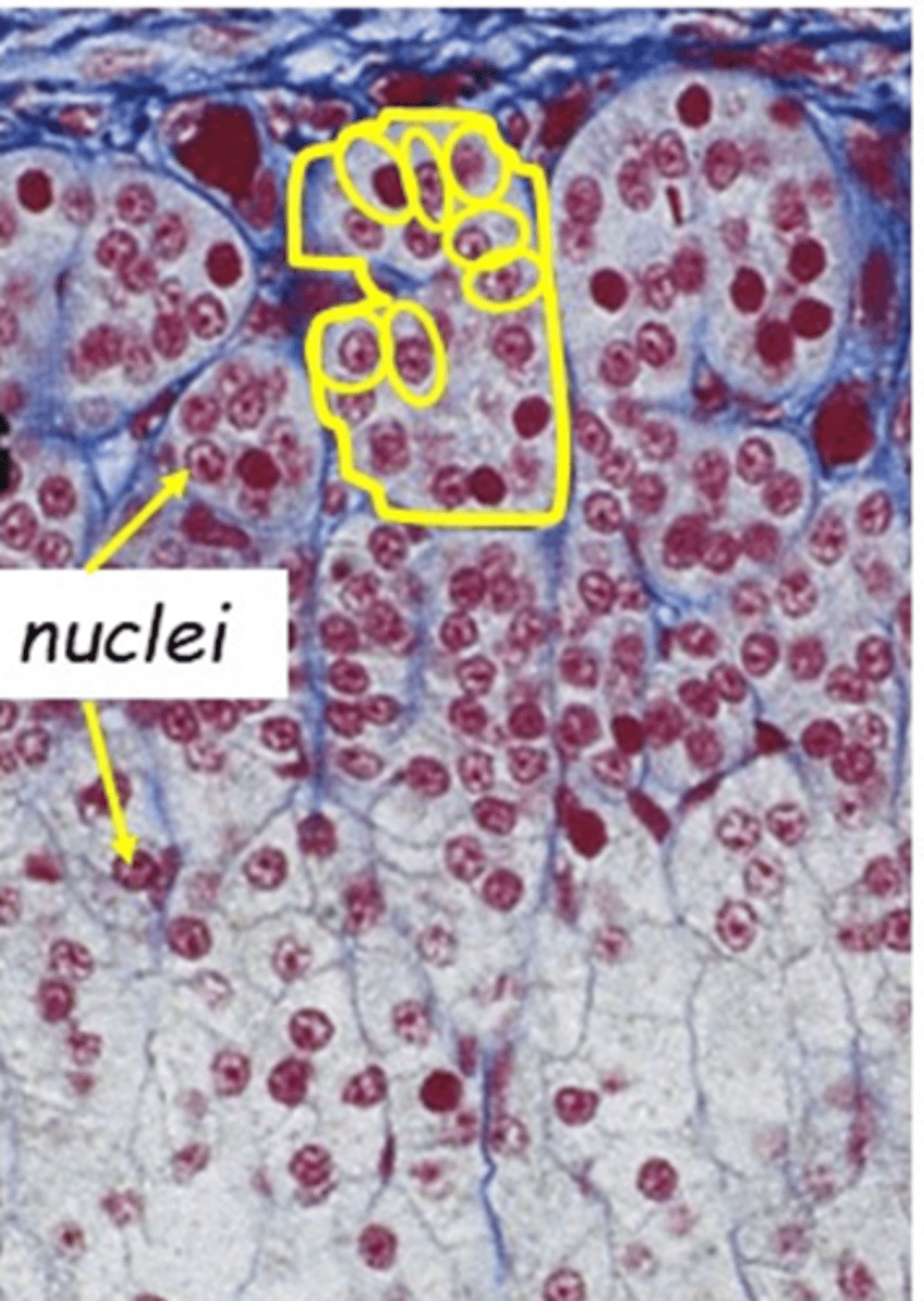 <p>What region of the adrenal gland is displayed here?</p>