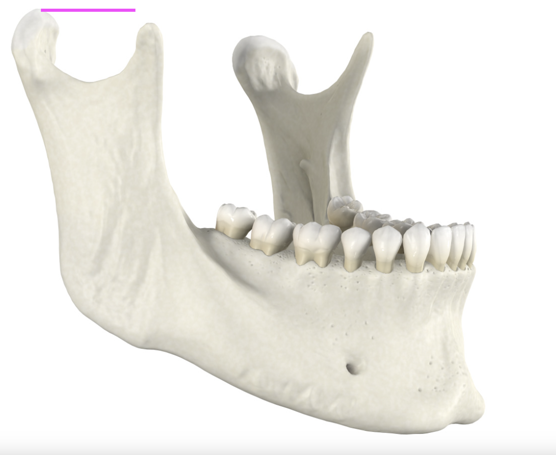 <p>What bone marking is this?</p>