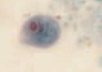 <p>Identify the organism and stage</p>