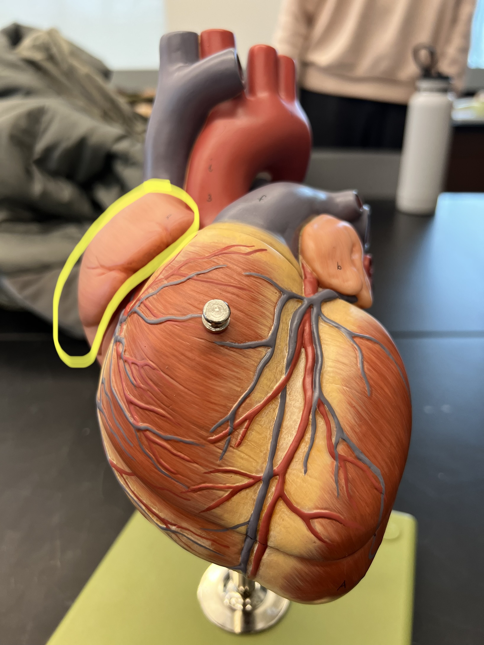 Name the heart structure.