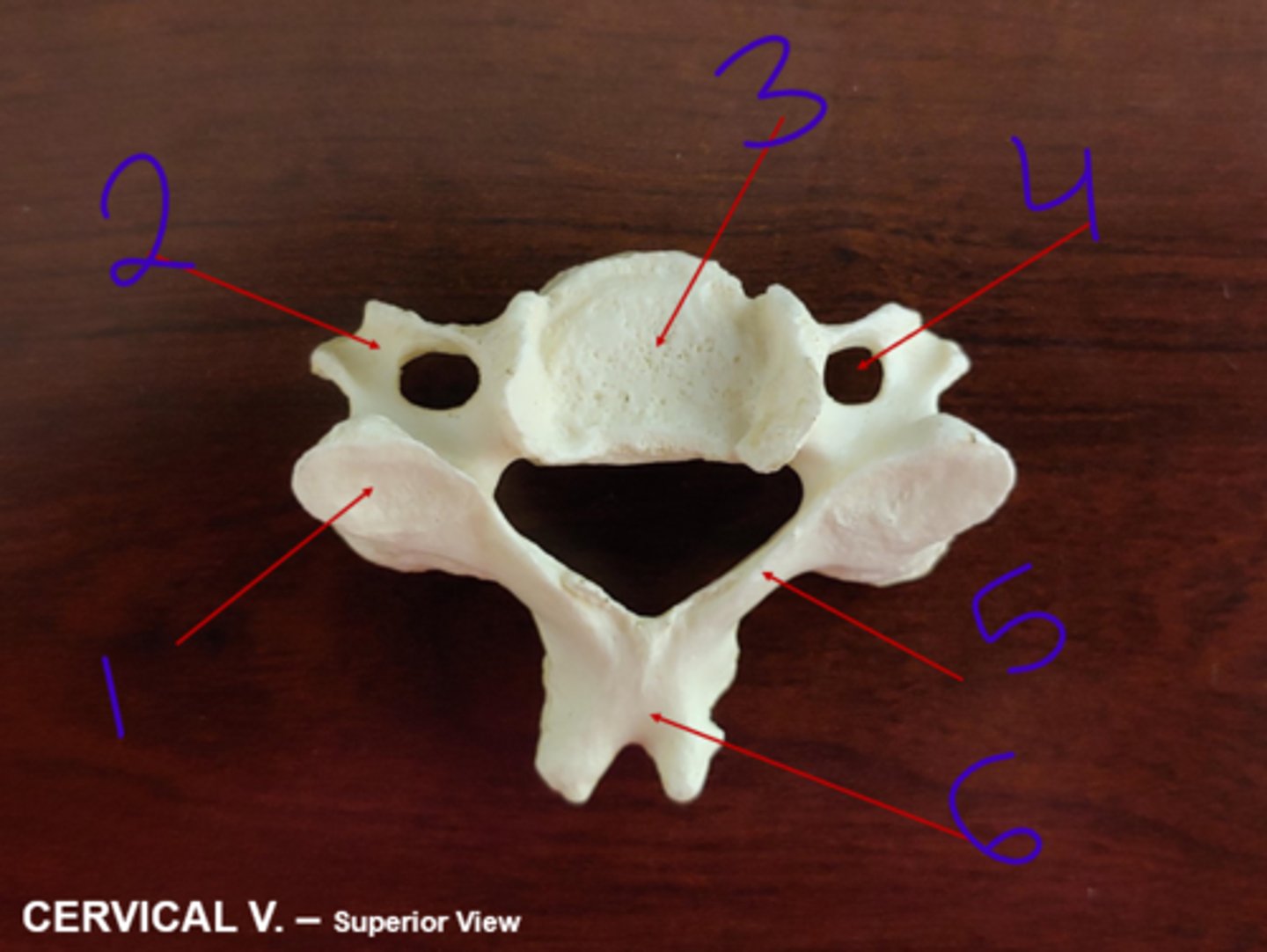 <p>cervical - #5</p>